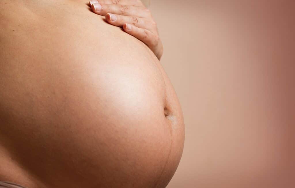 Pregnancy without stretch marks